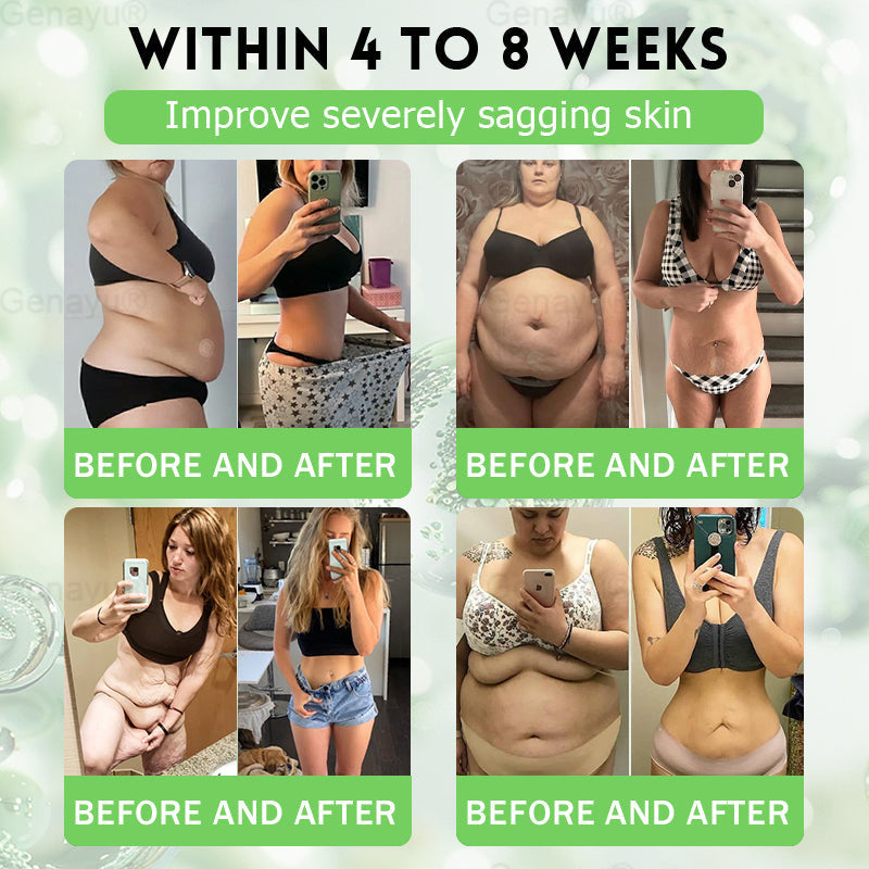 🔥 Limited-Time Event — 50% OFF Today!  After testing with tens of thousands of users, we found that using the 𝐃𝐎𝐓𝐀𝐋𝐄® Weight Loss Patch together with our shaping underwear helps support even better results. ✨